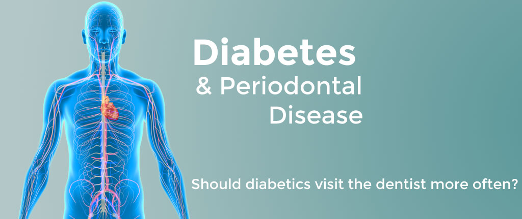 Diabetes & Periodontal Disease