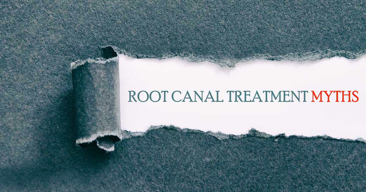 root canal myths