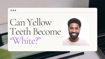 Can Yellow Teeth Become White Again In Hoffman Estates?
