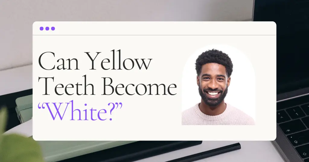 Can Yellow Teeth Become White Blog Header
